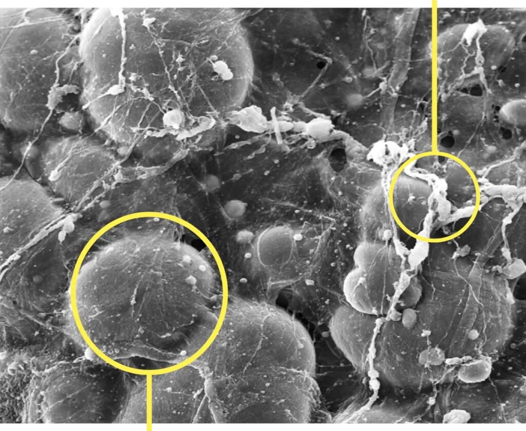 Microscope image of alloClae at 250x magnification showing intact fat cells and extracellular matrix