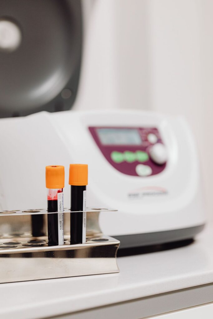 Two blood sample tubes with orange caps in a metal rack in front of a white laboratory centrifuge