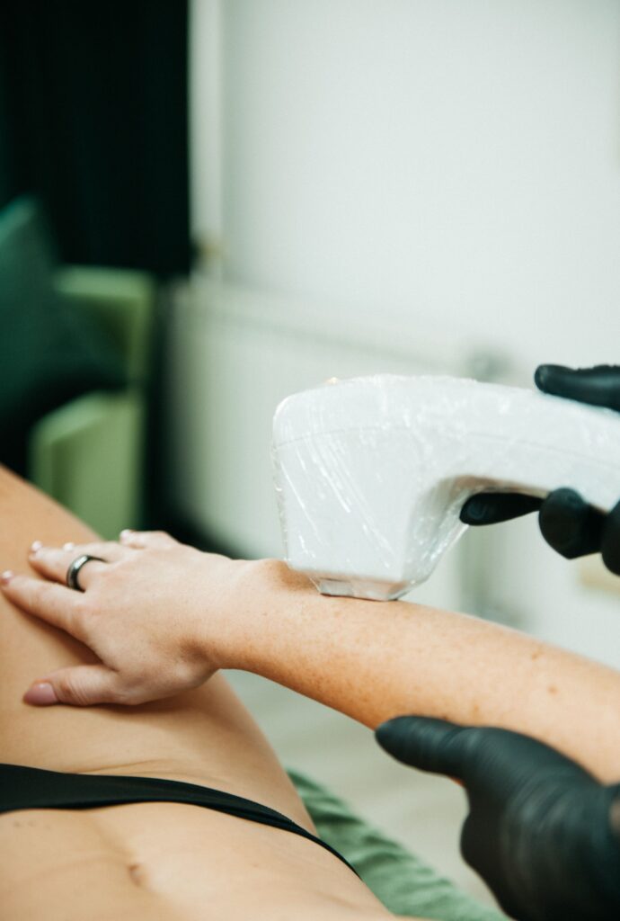 Close-up of a provider in black gloves guiding a laser handpiece over a client's forearm in a clinic