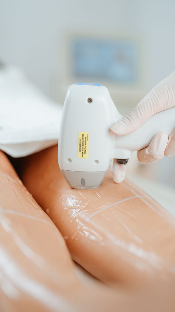 Close-up of a gloved hand moving a laser handpiece over a client's legs