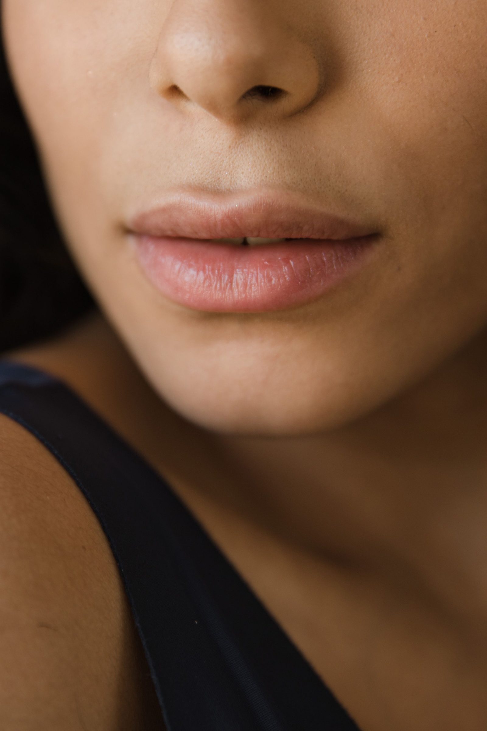 Close-up of natural, softly defined lips and chin, illustrating lip filler goals