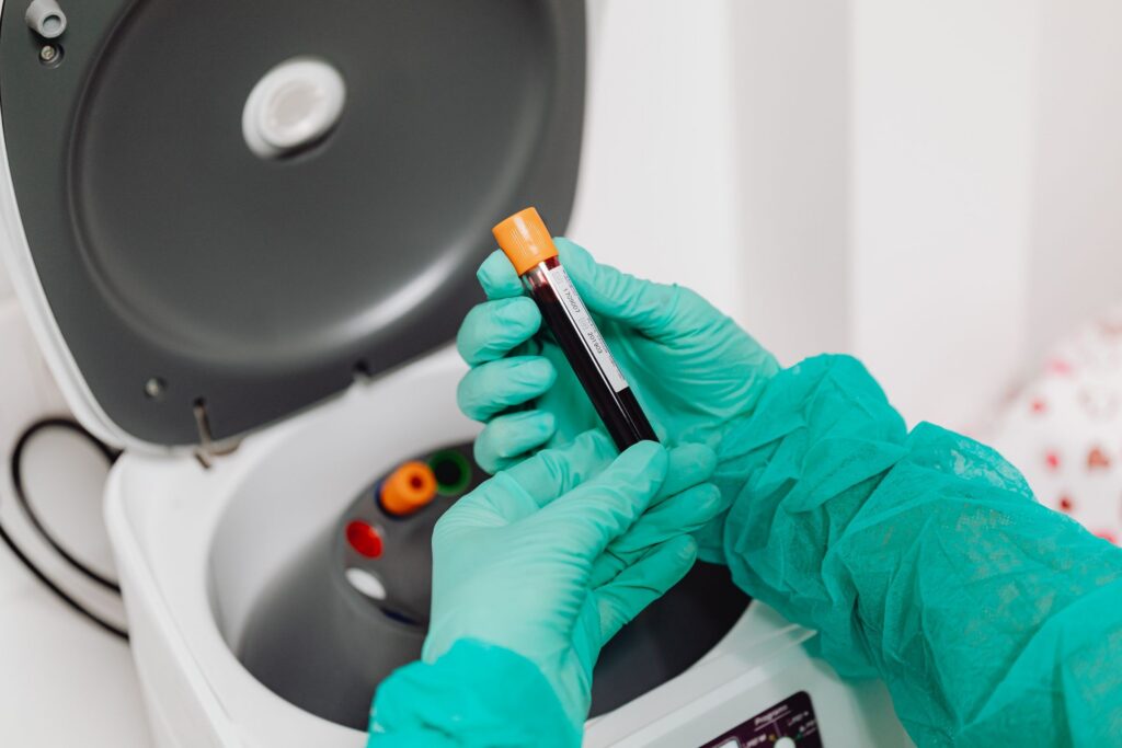 Gloved hands holding a blood collection tube beside an open laboratory centrifuge